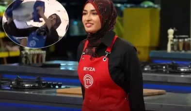 MasterChef Beyza, yanmış yüzünün fotoğrafını “Hassas içerik” notuyla paylaştı